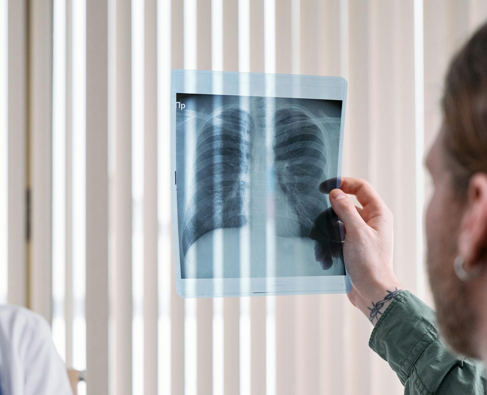 Doctor reviewing X-ray related to a missed diagnosis medical malpractice case.